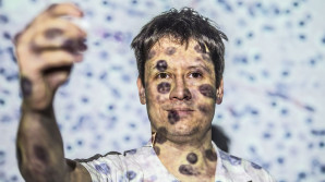 Koblížek: AI patologa nenahradí, jeho práci zefektivní