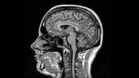 MRI_blackandwhite_original