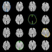 Neuroscience_image_QBI_2012_15_veronika_halasz_diok_original