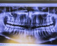 galerie_4_original