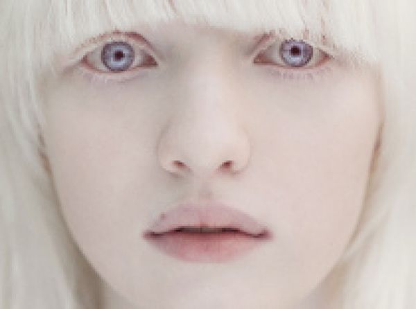 Proč je albinismus oblíbený v dnešní populární kultuře? Dozvíte se v Hrdličkově muzeu